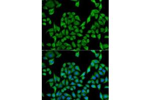 Immunofluorescence (IF) image for anti-UDP Glucuronosyltransferase 1 Family, Polypeptide A1 (UGT1A1) (AA 1-200) antibody (ABIN6149895)