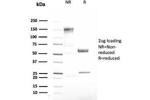 SDS-PAGE Analysis Purified Alpha-1-Antitrypsin Recombinant Rabbit Monoclonal (AAT/3167R).