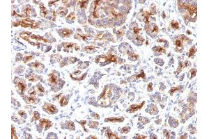 Formalin-fixed, paraffin-embedded human Pancreas stained with CFTR Monoclonal Antibody (SPM176). (CFTR Antikörper)