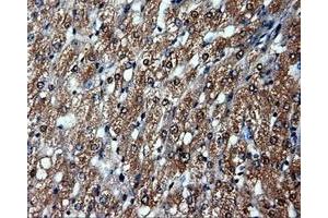 Immunohistochemical staining of paraffin-embedded prostate tissue using anti-HSP90AA1mouse monoclonal antibody. (HSP90AA1 Antikörper)