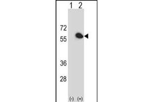 Western blot analysis of FKBP4 (arrow) using rabbit polyclonal FKBP4 Antibody (Center) (ABIN391579 and ABIN2841513). (FKBP4 Antikörper  (AA 186-216))