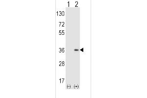 Western blot analysis of SULT1A1 using rabbit polyclonal SULT1A1 Antibody (Y143) using 293 cell lysates (2 ug/lane) either nontransfected (Lane 1) or transiently transfected (Lane 2) with the SULT1A1 gene. (SULT1A1 Antikörper  (AA 128-160))