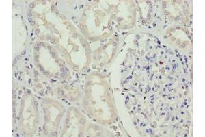 Immunohistochemistry of paraffin-embedded human kidney tissue using ABIN7168881 at dilution of 1:100 (SDSL Antikörper  (AA 39-169))