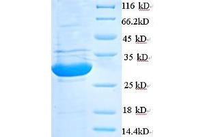 SDS-PAGE (SDS) image for phospholipase A2, Group V (PLA2G5) (AA 21-137) protein (His-SUMO Tag) (ABIN5710109) (PLA2G5 Protein (AA 21-137) (His-SUMO Tag))