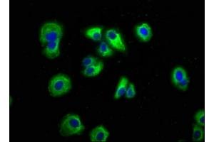 Immunofluorescence staining of HepG2 cells with ABIN7145127 at 1:166, counter-stained with DAPI. (AXIN2 Antikörper  (AA 11-77))