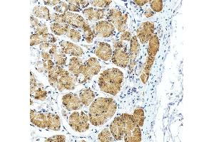 IHC analysis of RPS2 using anti-RPS2 antibody (ABIN7601997). (RPS2 Antikörper  (AA 54-293))