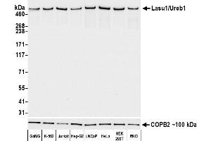 Western Blotting (WB) image for anti-HECT, UBA and WWE Domain Containing 1, E3 Ubiquitin Protein Ligase (HUWE1) (AA 2250-2300) antibody (ABIN7455157)