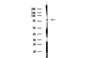 anti-Glutamate-Cysteine Ligase, Catalytic Subunit (GCLC) (N-Term) antibody