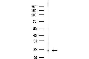 anti-Transmembrane Protein 187 (TMEM187) antibody