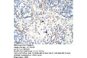 Human kidney (HKR1 Antikörper  (C-Term))