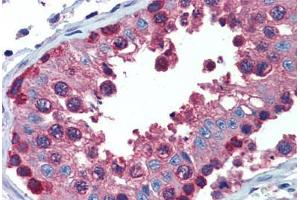 Testis, Human: Formalin-Fixed, Paraffin-Embedded (FFPE) (PDIA4 Antikörper  (AA 623-638))