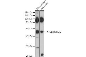 Immunofluorescence analysis of U2OS cells using ATGL/PNPL antibody (ABIN6132218, ABIN6145857, ABIN6145858 and ABIN6221844) at dilution of 1:100. (PNPLA2 Antikörper  (AA 265-504))