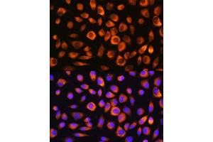 Immunofluorescence analysis of L929 cells using Hsc70/HSP Rabbit pAb (ABIN3016123, ABIN3016124, ABIN3016125 and ABIN6219558) at dilution of 1:100. (Hsc70 Antikörper  (AA 1-300))