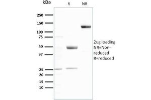 SDS-PAGE Analysis Purified Ubiquitin Recombinant Rabbit Monoclonal Antibody (UBB/3143R). (Rekombinanter Ubiquitin B Antikörper  (AA 1-119))