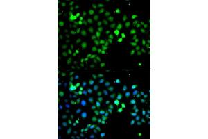 Immunofluorescence analysis of A549 cells using MTF2 antibody. (MTF2 Antikörper  (AA 1-190))