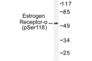Image no. 1 for anti-Estrogen Receptor 1 (ESR1) (pSer118) antibody (ABIN318018) (Estrogen Receptor alpha Antikörper  (pSer118))