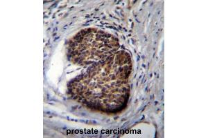 Immunohistochemistry (IHC) image for anti-Prostate Stem Cell Antigen (PSCA) antibody (ABIN2997805) (PSCA Antikörper)