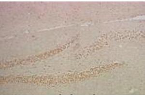 Immunohistochemistry of paraffin-embedded Mouse hippocampus tissue using NFκB-p65 Monoclonal Antibody at dilution of 1:200. (NF-kB p65 Antikörper)