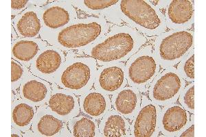 IHC analysis of KIF15 using anti-KIF15 antibody (ABIN6719385). (KIF15 Antikörper  (AA 1201-1388))