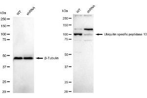 Western blotting analysis using Ubiquitin specific peptidase 13 antibody (ABIN7800726).
