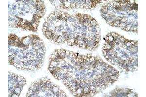APBA1 antibody was used for immunohistochemistry at a concentration of 4-8 ug/ml to stain Epithelial cells of intestinal villus (arrows) in Human Intestine. (APBA1 Antikörper  (N-Term))