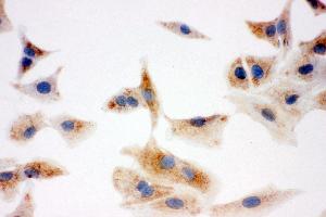 Immunohistochemistry (IHC) image for anti-Enoyl-CoA Delta Isomerase 1 (ECI1) (AA 272-290), (C-Term) antibody (ABIN3044153)