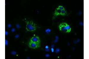 Image no. 3 for anti-Spastic Paraplegia 7 (SPG7) (AA 300-573) antibody (ABIN1491370) (SPG7 Antikörper  (AA 300-573))