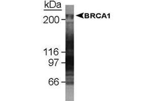 Western blot analysis of BRCA1 in U-2 OS whole cell lysate using BRCA1 monoclonal antibody, clone KEN . (BRCA1 Antikörper  (AA 1314-1864))