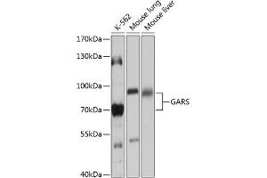 Western blot analysis of extracts of various cell lines, using GARS antibody (ABIN6127941, ABIN6140963, ABIN6140965 and ABIN6217253) at 1:1000 dilution. (GARS Antikörper  (AA 60-370))