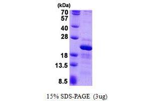 Ribosomal Protein S10 (RPS10) protein (His tag)
