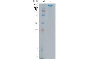 SDS-PAGE (SDS) image for Integrin beta-6 (ITGB6) (AA 22-707) protein (Fc Tag) (ABIN7538334)