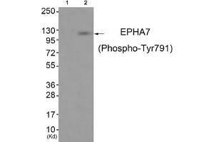 Western blot analysis of extracts from JK cells (Lane 2), using EPHA7 (Phospho-Tyr791) Antibody. (EPH Receptor A7 Antikörper  (pTyr791))