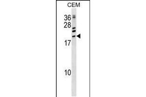 Western blot analysis in CEM cell line lysates (35ug/lane). (ATF3 Antikörper  (C-Term))