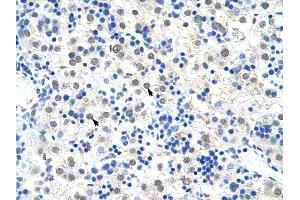 DDX47 antibody was used for immunohistochemistry at a concentration of 4-8 ug/ml to stain Hepatocytes (arrows) in Human Liver. (DDX47 Antikörper)