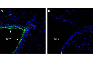 Expression of Parkin in rat  brain 4th ventricle. (Parkinson Protein 2, E3 Ubiquitin Protein Ligase (Parkin) (PARK2) Peptid)