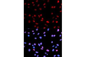 Immunofluorescence (IF) image for anti-Retinoblastoma 1 (RB1) (pSer795) antibody (ABIN1870564) (Retinoblastoma 1 Antikörper  (pSer795))
