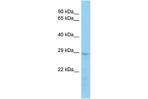 Host:  Rabbit  Target Name:  Tmem178  Sample Type:  Mouse Stomach lysates  Antibody Dilution:  1. (TMEM178 Antikörper  (N-Term))