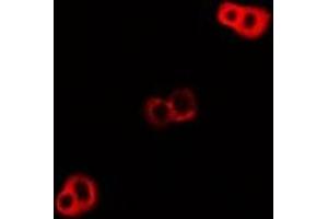 Immunofluorescent analysis of DNAJA3 staining in U2OS cells.