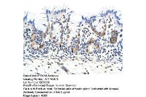Rabbit Anti-PRKRA Antibody  Paraffin Embedded Tissue: Human Stomach Cellular Data: Epithelial cells of fundic gland Antibody Concentration: 4. (PRKRA Antikörper  (Middle Region))