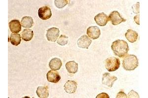 Immunohistochemistry (IHC) image for anti-Metastasis Associated 1 Family, Member 2 (MTA2) antibody (ABIN1031775)