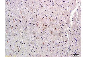 Formalin-fixed and paraffin-embedded rat brain labeled with Rabbit Anti-MTNR1A/MTR-1A/MEL-1A-R Polyclonal Antibody, Unconjugated (ABIN723815) at 1:300 followed by conjugation to the secondary antibody (Melatonin Receptor 1A Antikörper  (AA 201-280))