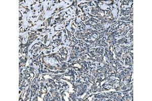 IHC analysis of SPG3A/ATL1 using anti-SPG3A/ATL1 antibody (ABIN7603095). (ATL1 Antikörper  (Middle Region))