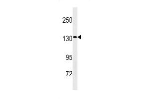 SS2 Antibody (Center) 20308c western blot analysis in HepG2 cell line lysates (35 μg/lane). (SAPS2 Antikörper  (AA 565-593))