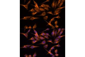 Immunofluorescence analysis of HeLa cells using UNG antibody (ABIN6135163, ABIN6149935, ABIN6149937 and ABIN6217044) at dilution of 1:100. (UNG Antikörper  (AA 1-100))