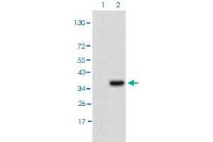 Western blot analysis of Lane 1: HEK293T cell lysate, Lane 2: IL3RA (a. (IL3RA Antikörper)