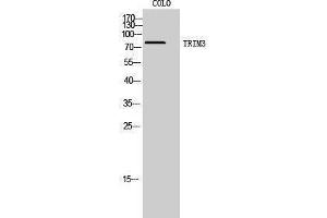 Western Blotting (WB) image for anti-Tripartite Motif Containing 3 (TRIM3) (N-Term) antibody (ABIN3187338) (TRIM3 Antikörper  (N-Term))