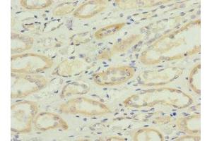 Immunohistochemistry of paraffin-embedded human kidney tissue using ABIN7170943 at dilution of 1:100 (Sulfide:quinone Oxidoreductase, Mitochondrial (SQOR) (AA 211-450) Antikörper)