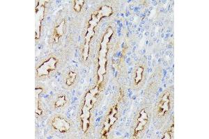 Immunohistochemistry of paraffin-embedded mouse kidney using Nectin 2/CD112 Rabbit mAb (ABIN7269432) at dilution of 1:100 (40x lens). (PVRL2 Antikörper)