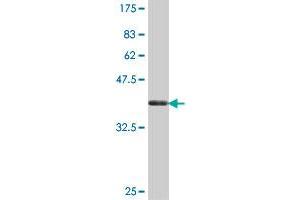 Western Blotting (WB) image for anti-Purinergic Receptor P2X, Ligand-Gated Ion Channel, 5 (P2RX5) (AA 126-224) antibody (ABIN562081)