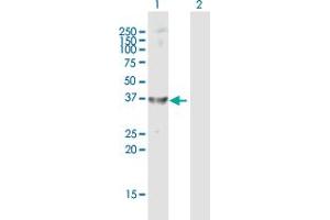 Western Blot analysis of AKR1C4 expression in transfected 293T cell line by AKR1C4 MaxPab polyclonal antibody. (AKR1C4 Antikörper  (AA 1-323))